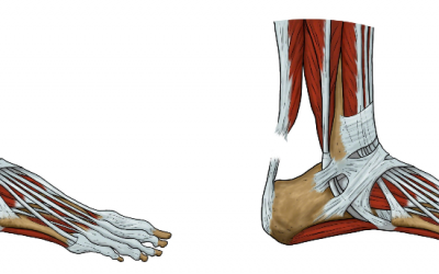 Achilles Tendinopathy