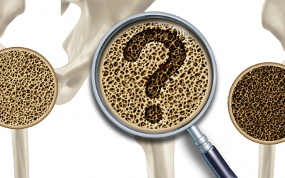 What is the difference between Osteoporosis and Osteoarthritis?