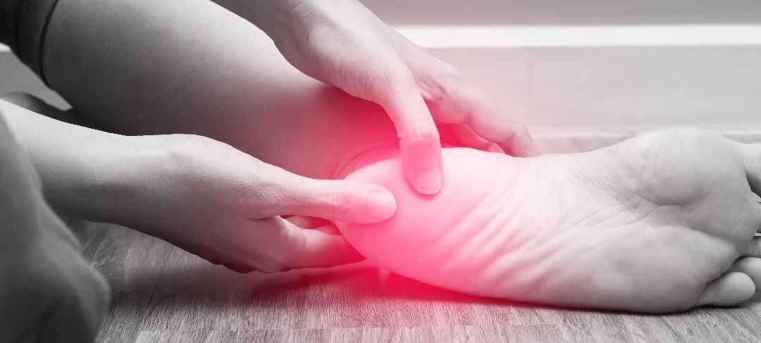 Plantar Fasciitis - Heel Pain Top Ten Tips - Perfect Balance Clinic