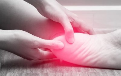 Ten tips to cure PLANTAR FASCIITIS (Heel Pain)