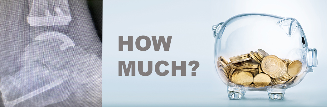 How Much Does An Ankle Replacement Cost?